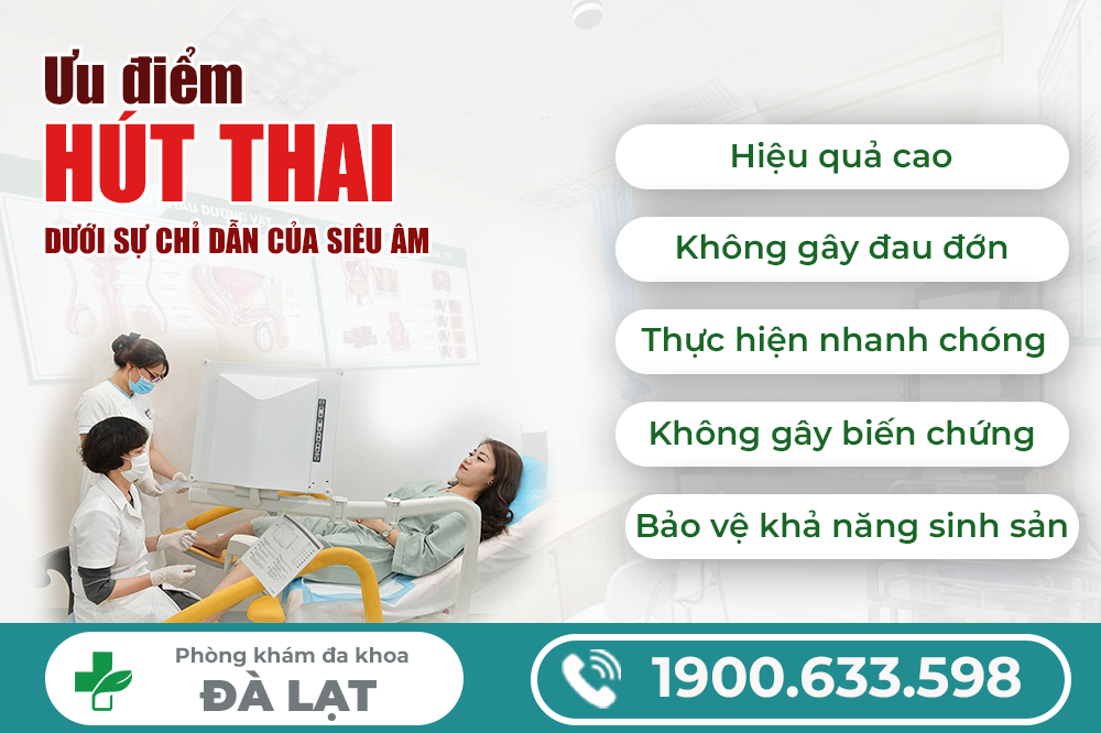 Hình ảnh minh họa
